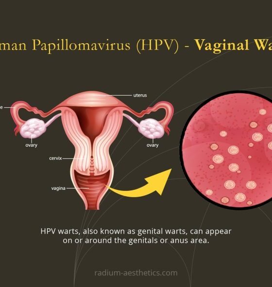 Points To Know About Human Papillomavirus