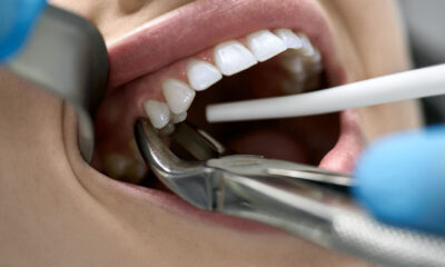 Remedy For Toothache
