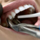Remedy For Toothache