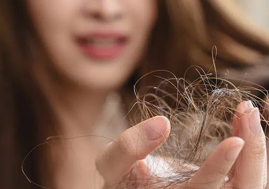 Hair Loss