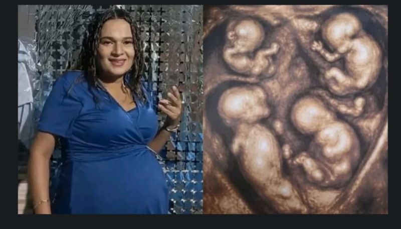 Quadruplets